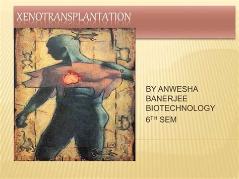 Xenotransplantation A Solution To Organ Shortage Ppt
