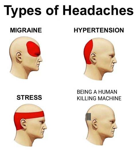 Headache Chart What Does Headache Location Mean