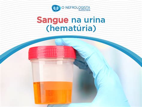Sangue Na Urina O Nefrologista