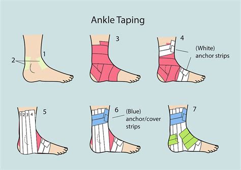 Ankle Taping For Sprained Ankle Injury