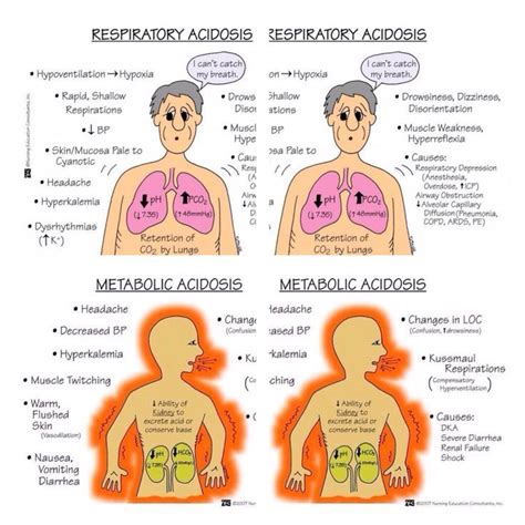 Metabolic Acidosis Respiratory Acidosis Pendidikan Medis