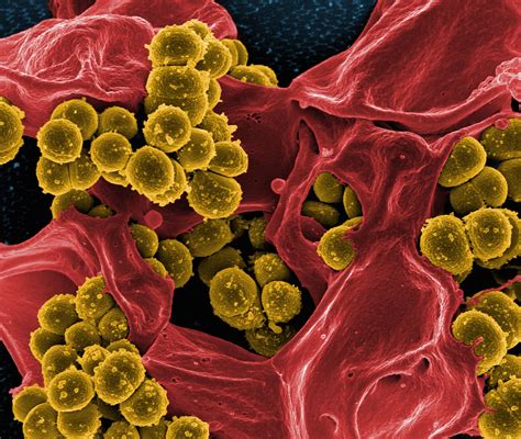 Powerful Promising New Molecule May Snuff Antibiotic Resistant