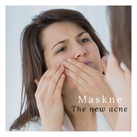 Maskne Is The New Acne Melanin Aesthetics And Laser Clinic