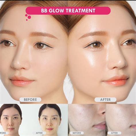 Korean Bb Glow Treatment Limited Time Only Beauty And Personal Care