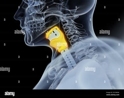 Human Thyroid Gland Anatomy Xray Image Glowing Thyroid 3d
