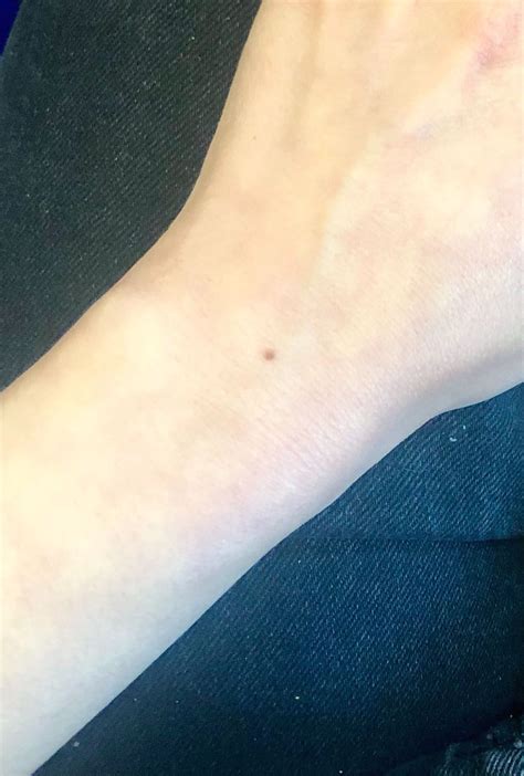 Viral Wrist Freckle Challenge Has People Sharing Photos Of Matching Moles On Arms Allure