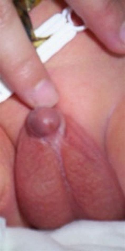 Erect Penis Into Vagina