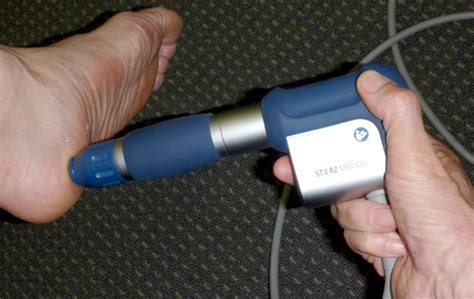 Figure 9 Extracorporeal Shock Wave Therapy Being Applied To The