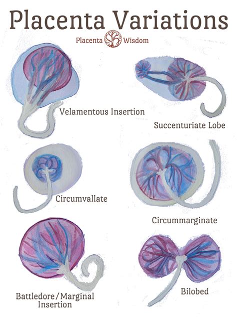 Placenta Variations Student Midwife Midwifery Student Nurse Midwife