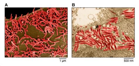 Marburg virus is a hemorrhagic fever virus of the filoviridae family of viruses and a member of the species marburg marburgvirus, genus marburgvirus. Filoviridae. A) Scanning electron micrograph of Marburg ...