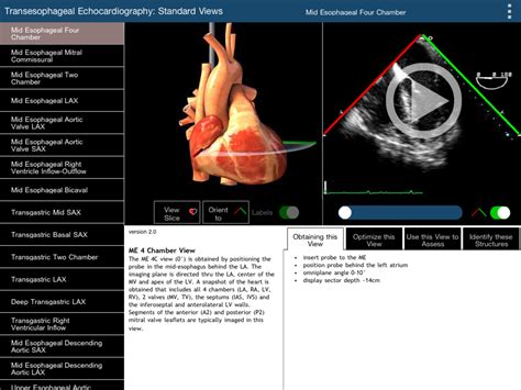 The Five Best Apps For Echocardiography Medpage Today