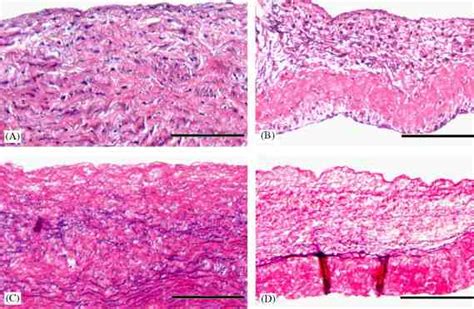 Histology Of Native And Decellularized Pv Hande Staining A Native