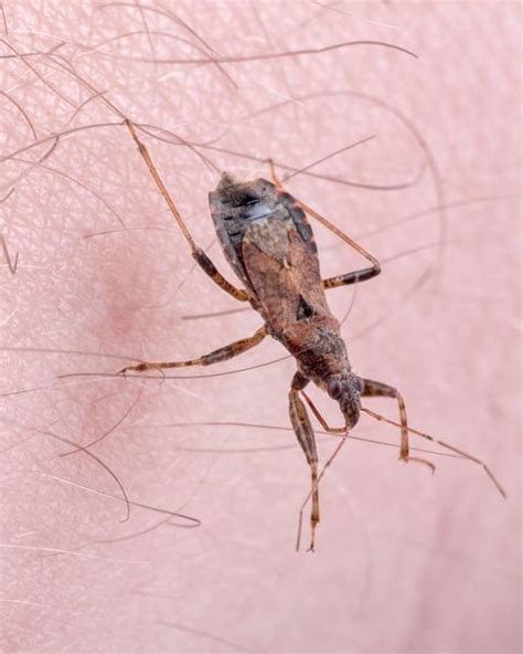 Deadly Kissing Bug Bites And Spreads Chagas Disease Through Poop