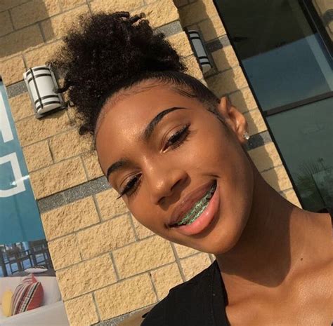 Follow Me For More 😍amourrxkay Cute Braces Colors Pretty Teeth