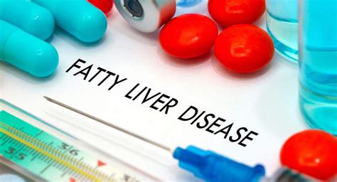 fatty liver now affects one in three australians cabot health