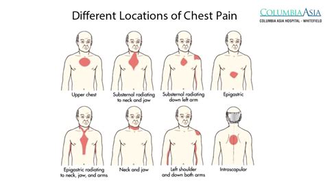 How To Assess The Chest Pain Youtube