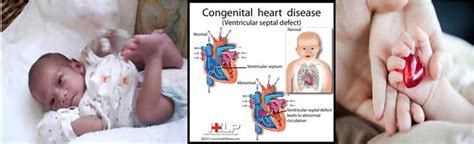 Congenital Heart Disease Ijn