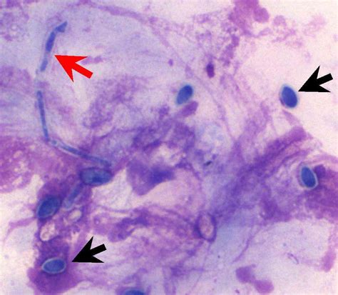 Fungal Keratitis In A Dog Case Study Cytopath