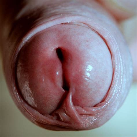 Close Up Penis Head Glans