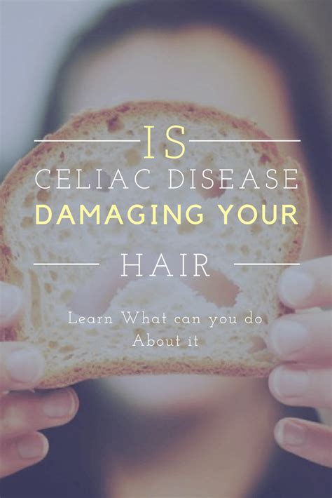 Can Celiac Disease Cause Hair Loss