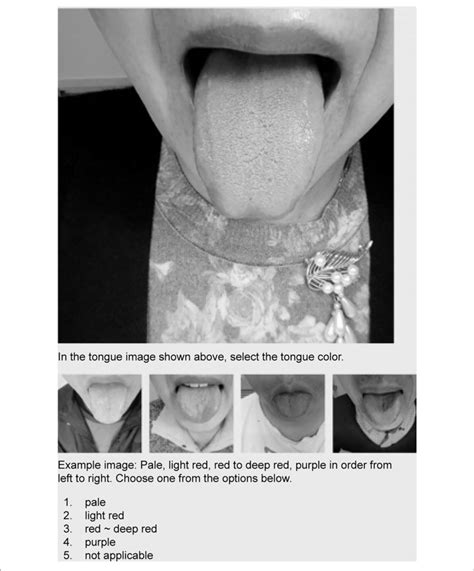 Screen Of Tongue Diagnosis Test Using E Learning System Candidates