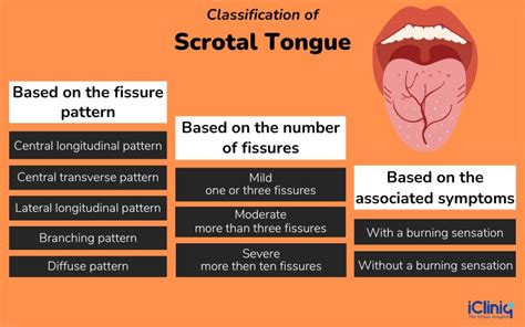 Scrotal Tongue Causes Symptoms Diagnosis Treatment