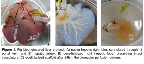 Periodic Reporting For Period 1 Liver Bioengineering Ex Vivo Re