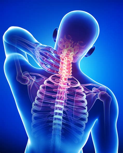 Neck Pain Institute Of Osteopathy
