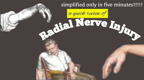 Radial Nerve Injury Wrist Dropsaturday Night Palsy Radial Nerve