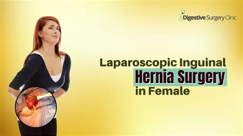 Laparoscopic Inguinal Hernia Surgery In Female At Digestive Surgery