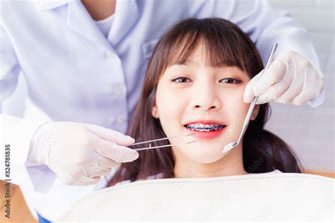 Asian Doctor Dentist Examine Female Patient With Braces In A Dental