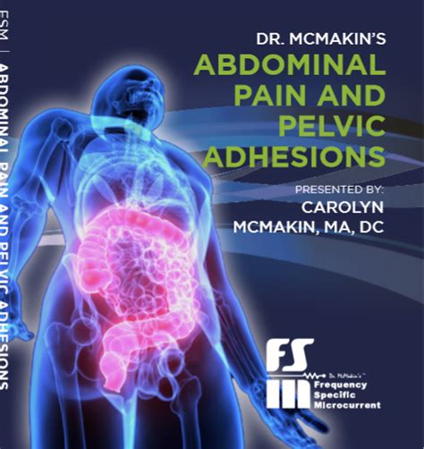 Abdominal Pain And Pelvic Adhesions Dr Carolyn McMakin Frequency Specific Microcurrent