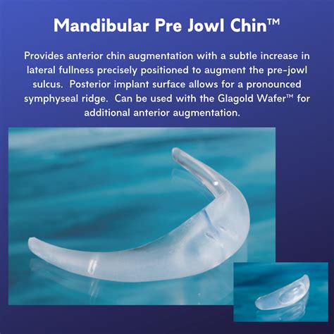 Mandibular Pre Jowl Chin™ Implantech Chin Augmentation Jowl