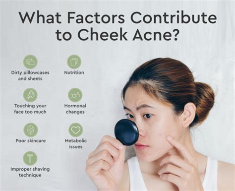 How To Get Rid Of Cheek Acne 10 Causes And Treatments Bioclarity