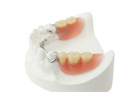 Removable Partial Denture Sinterex