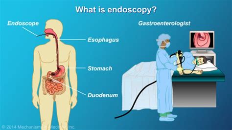 Endoscopy Is A Medical Procedure In Which A Flexible Instrument That