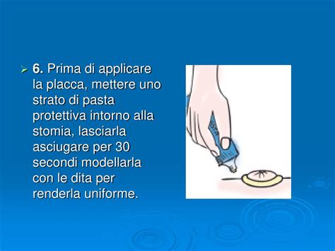 Cura e gestione della #stomia. PPT - LA STOMIA PowerPoint Presentation, free download - ID:905799