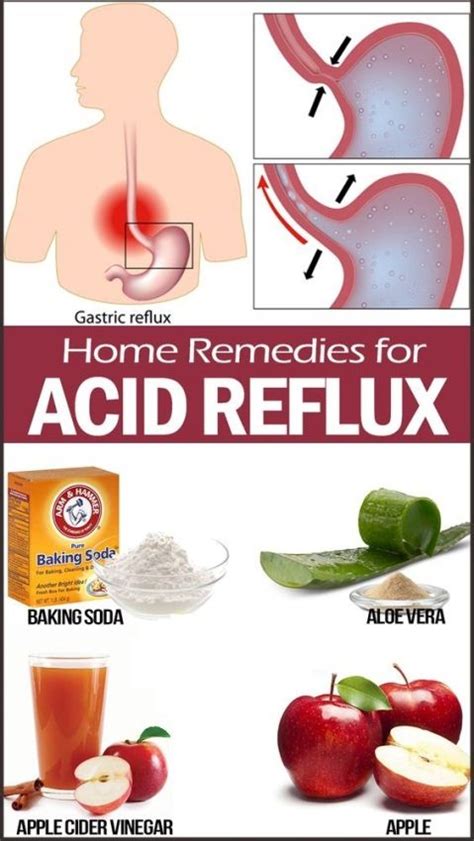 I had acid reflux for a year: 34 best Compression Sleeves images on Pinterest ...