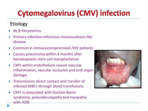 Priya Seminar On Ulcerativevesicular And Bullous Lesions