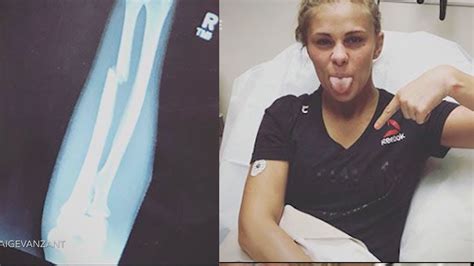 Paige Vanzant Breaks Her Arm Landing Spinning Back Fist On Jessica Rose