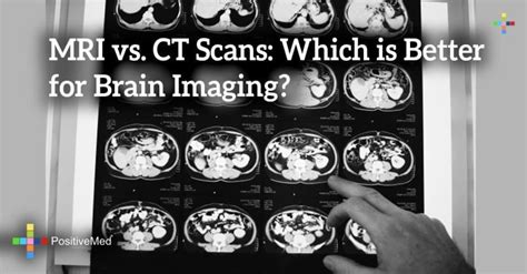 Mri Vs Ct Scans Which Is Better For Brain Imaging