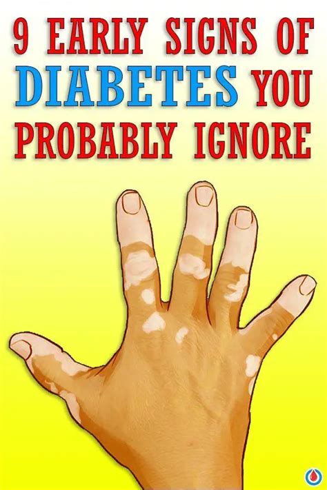 9 Early Signs Of Diabetes We Probably Ignore Diabetes Health Page