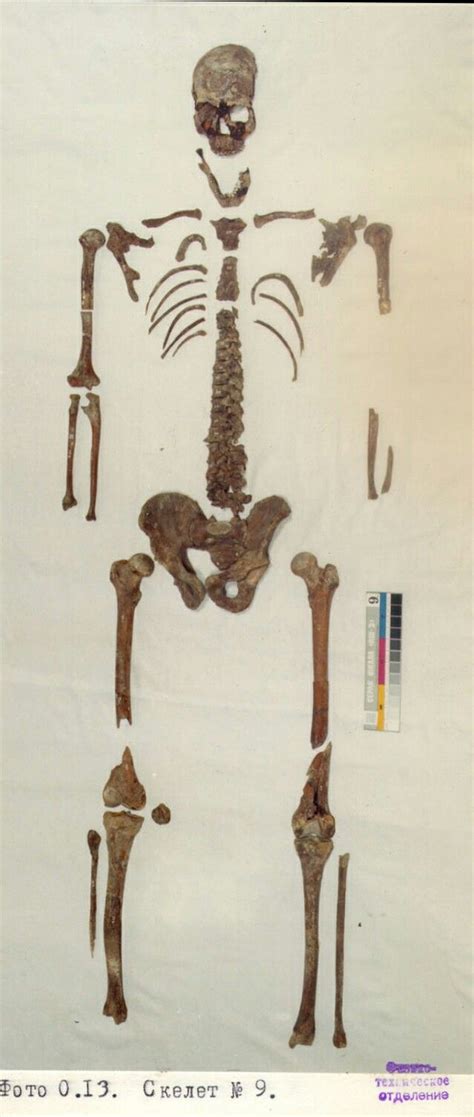 The Skeletal Remains Of Alexei Alois Yegorovich Trupp 8 April 1856 17