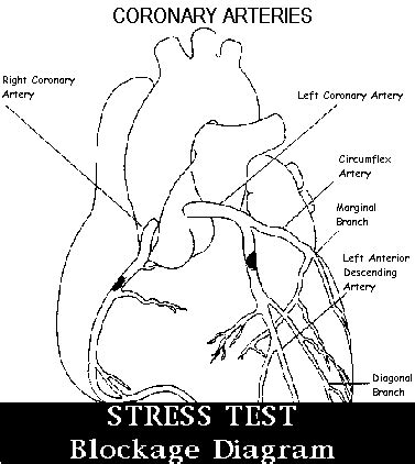 Arterial supply to the left lower extremity a sciatic. mypicsain: arteries of heart diagram
