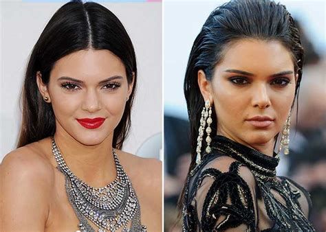 Her lovely look has captured millions of fans globally, and when she stepped into modelling, folks questioned if plastic surgery was the key behind her beauty. Kendall Jenner Plastic Surgery: Nose Job, Boob Job, Lip ...