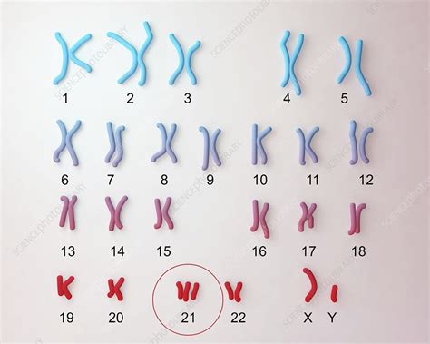Downs Syndrome Karyotype Illustration Stock Image F0134423 Science Photo Library