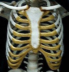 The first rib is often fractured axial computed tomography image of multiple left upper rib fractures and a traumatic aortic rupture. How many ribs are there in the body? - Quora