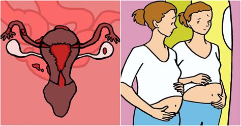 Early ovarian cancer rarely has symptoms. 6 Concerning Symptoms Of Ovarian Cysts Women Of All Ages ...