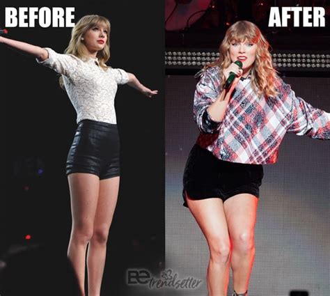 Taylor Swift Plastic Surgery Mystery Solved