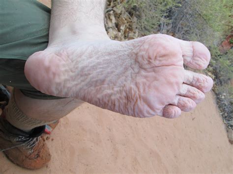 Water Logged Feet Doug Mccaughan Flickr